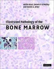 Illustrated Pathology of the Bone Marrow, (0521810035), Attilio Orazi 