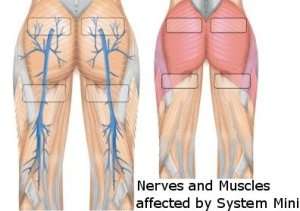   the bottom results in 8 weeks when used for 30 minutes 5 times a week