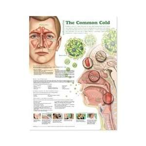 Understanding the Common Cold Anatomical Chart, 2nd Edition:  