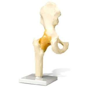  Anatomical Models   Hip Joint, Functional Health 