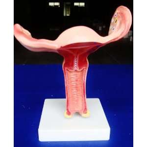 Model Anatomy Professional Medical Uterus Magnified New IT 086 ANGELUS